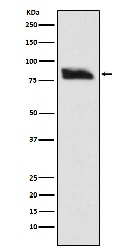 SMURF2 Rabbit mAb