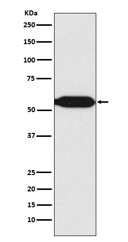 MEF2C Rabbit mAb