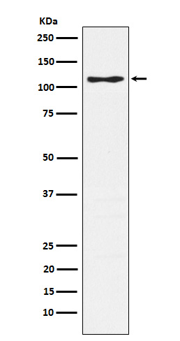 PSGL1 Rabbit mAb