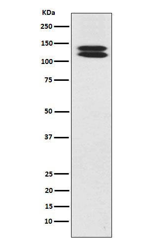 H Cadherin Rabbit mAb