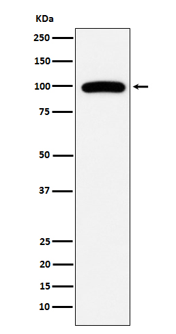 CD10 Rabbit mAb