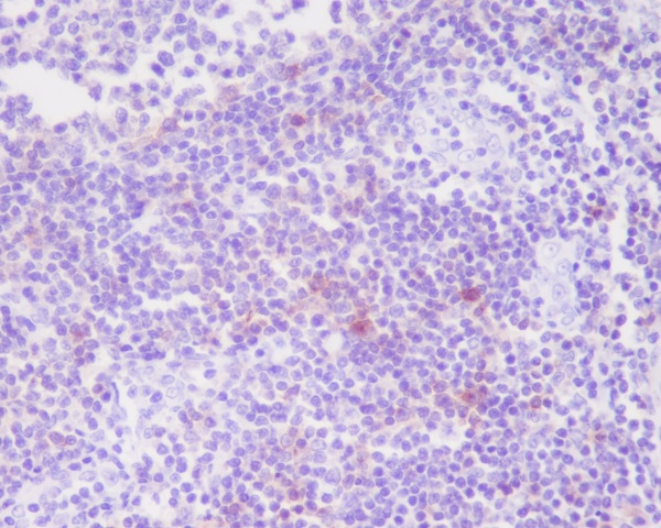 IL-2 Receptor alpha Rabbit mAb