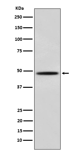 Myoblast Determination Protein 1 Rabbit mAb