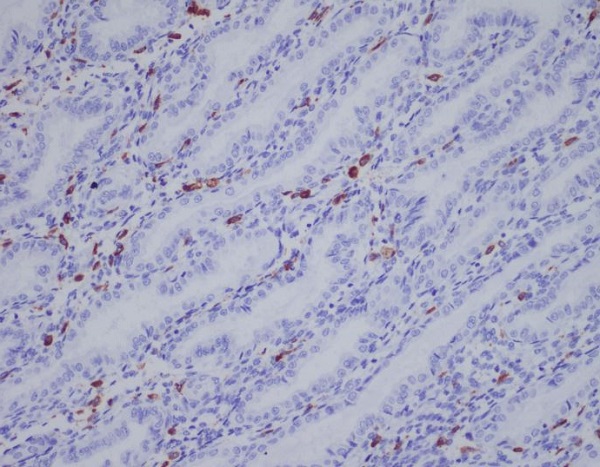 Iba1 Rabbit mAb