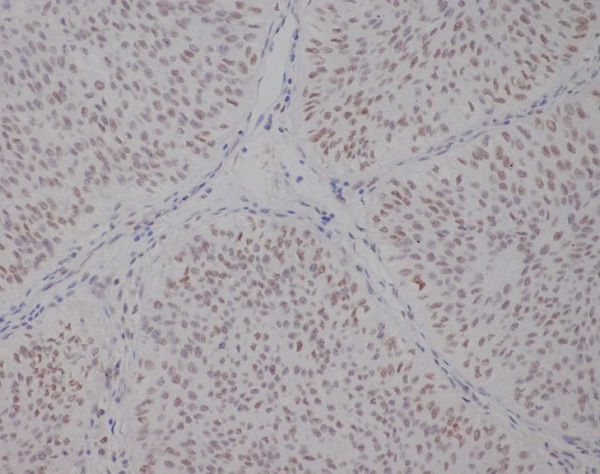 Transcription Factor E3 Rabbit mAb