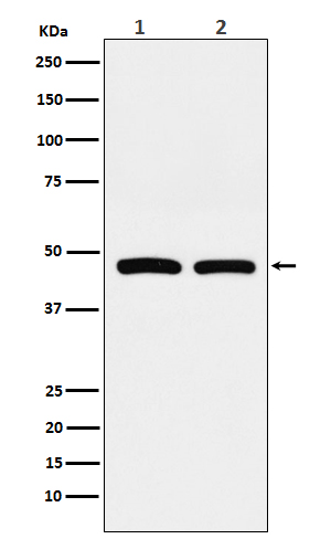 FDFT1 Rabbit mAb