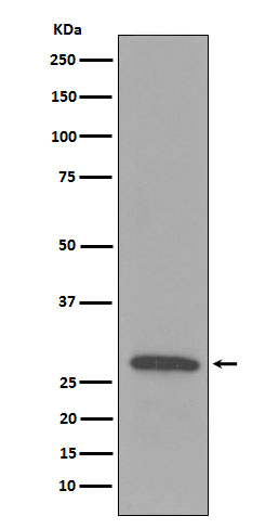 C1QB Rabbit mAb