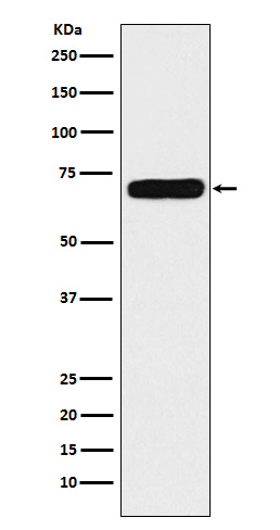 NPR3 Rabbit mAb