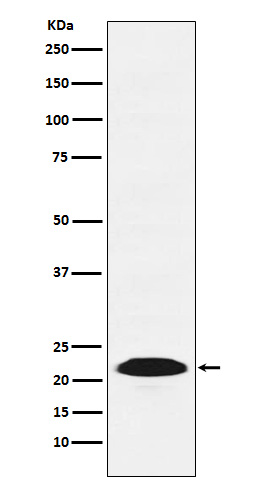 Proteasome beta 9 Rabbit mAb