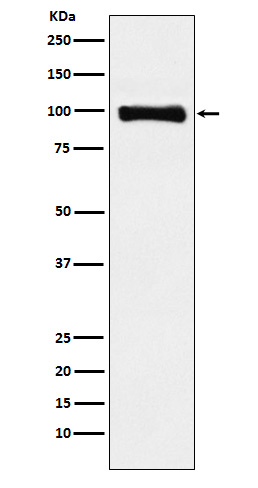 PIWIL1 Rabbit mAb