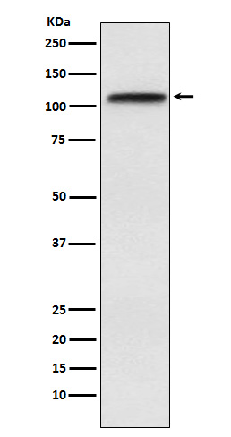 CRM1 Rabbit mAb