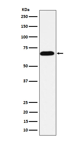 Intestinal Alkaline Phosphatase Rabbit mAb