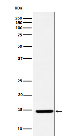 CDKN2A/p14ARF Rabbit mAb