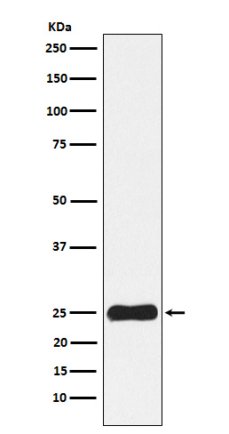 Casein Kinase 2 beta Rabbit mAb