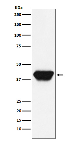 SPI1 Rabbit mAb