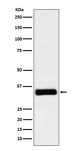 IGFBP2 Rabbit mAb