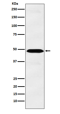 IL-13 Receptor alpha 1 Rabbit mAb