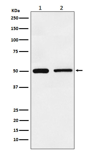 Hepatitis A Virus Cellular Receptor 1 Rabbit mAb