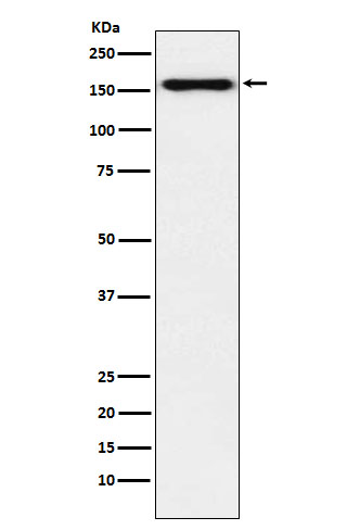 Desmoglein 2 Rabbit mAb