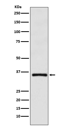 DMRT1 Rabbit mAb