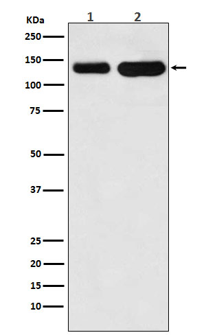 K Cadherin Rabbit mAb