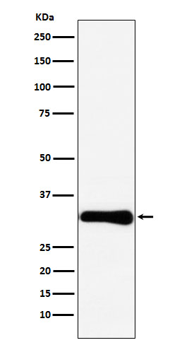 Bcl10 Rabbit mAb