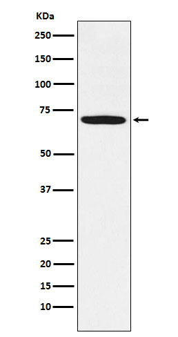 LIM Kinase 1 Rabbit mAb