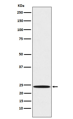 MAD2L1 Rabbit mAb