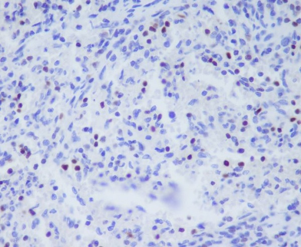 T Box Protein 21 Rabbit mAb