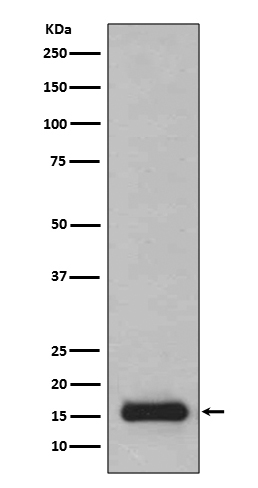 PFDN5 Rabbit mAb