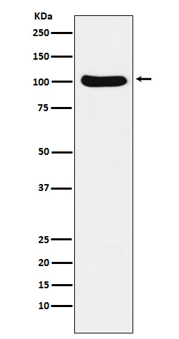 Cellular Apoptosis Susceptibility Rabbit mAb