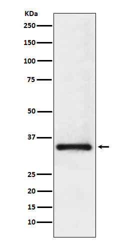 U1A Rabbit mAb