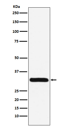 PSME1 Rabbit mAb