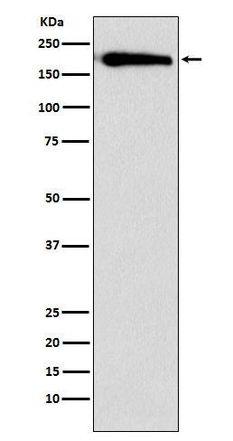 SMARCC1 Rabbit mAb