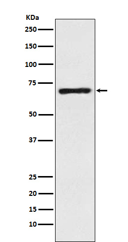 GABA Transporter 1 Rabbit mAb