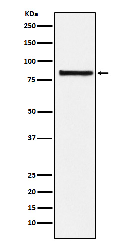 eIF2B5 Rabbit mAb