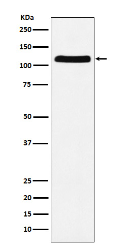 E1 Ubiquitin Activating Enzyme Rabbit mAb