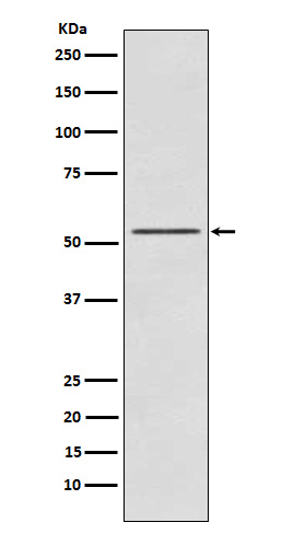 S6K2 Rabbit mAb