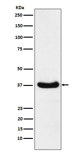 AKR1C3 Rabbit mAb