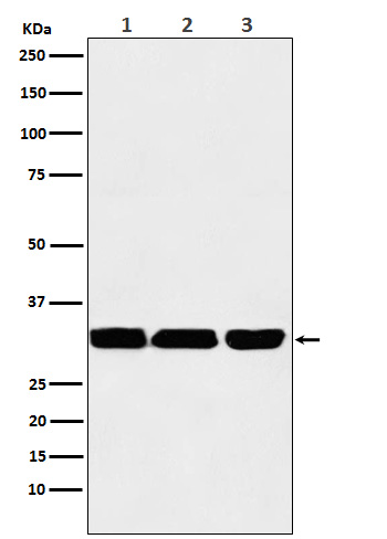 p53 DINP1 Rabbit mAb