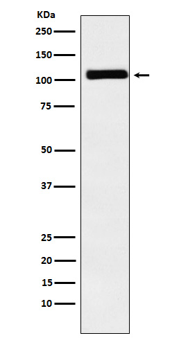 MIB1 Rabbit mAb