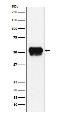 Fibrinogen gamma Chain Rabbit mAb