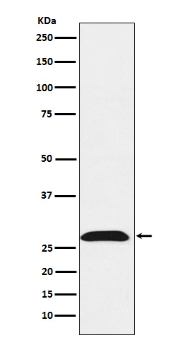 RhoGDI Rabbit mAb