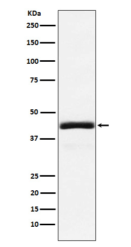 NEK2 Rabbit mAb