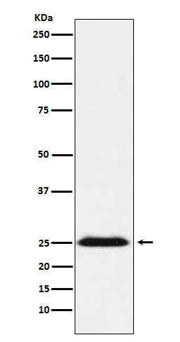 BAP31 Rabbit mAb