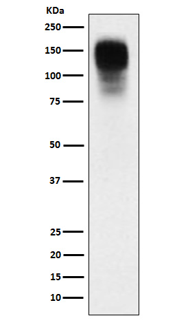 CEACAM1 Rabbit mAb