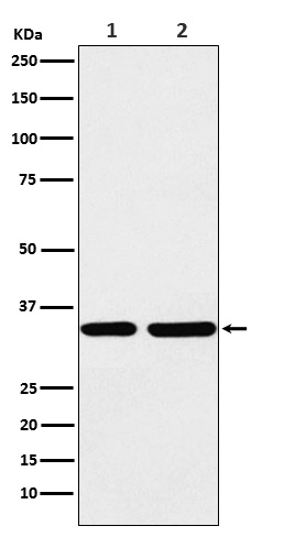 STUB1 Rabbit mAb