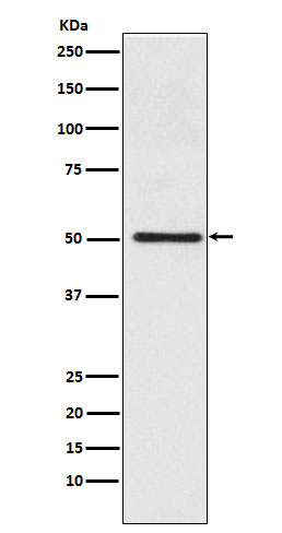 Cytochrome P450 17A1 Rabbit mAb