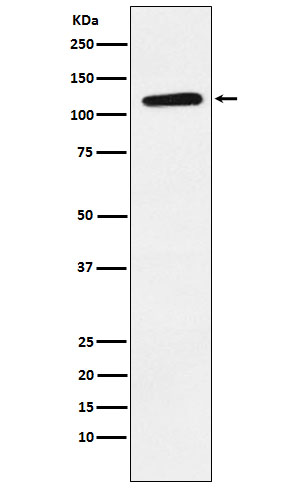 Ephrin Receptor B1 Rabbit mAb