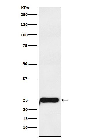 COMT Rabbit mAb